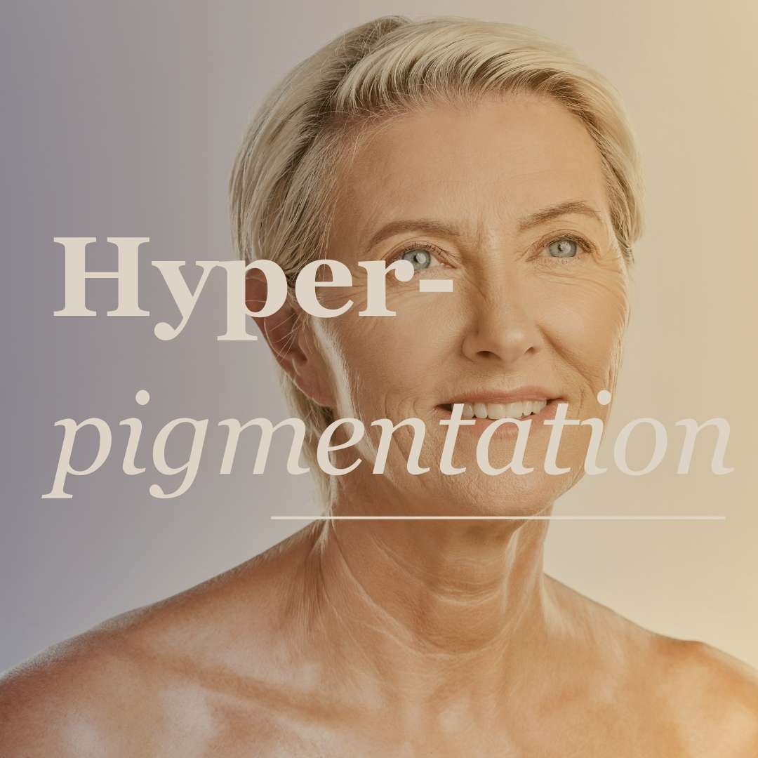 Hyperpigmentation