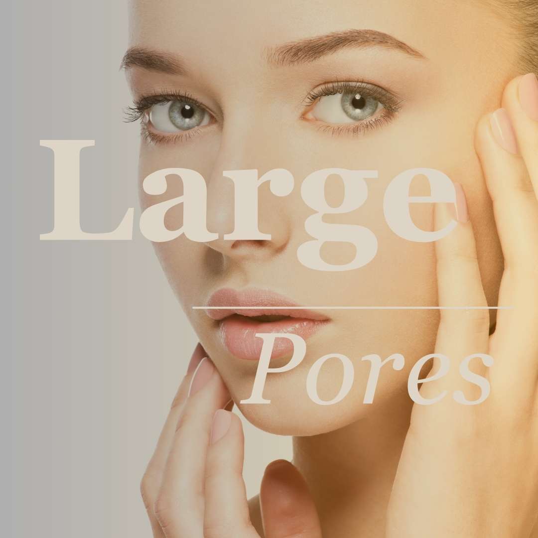 Large Pores