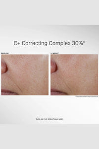 REVISION | C+ Correcting Complex 30% 1 fl oz