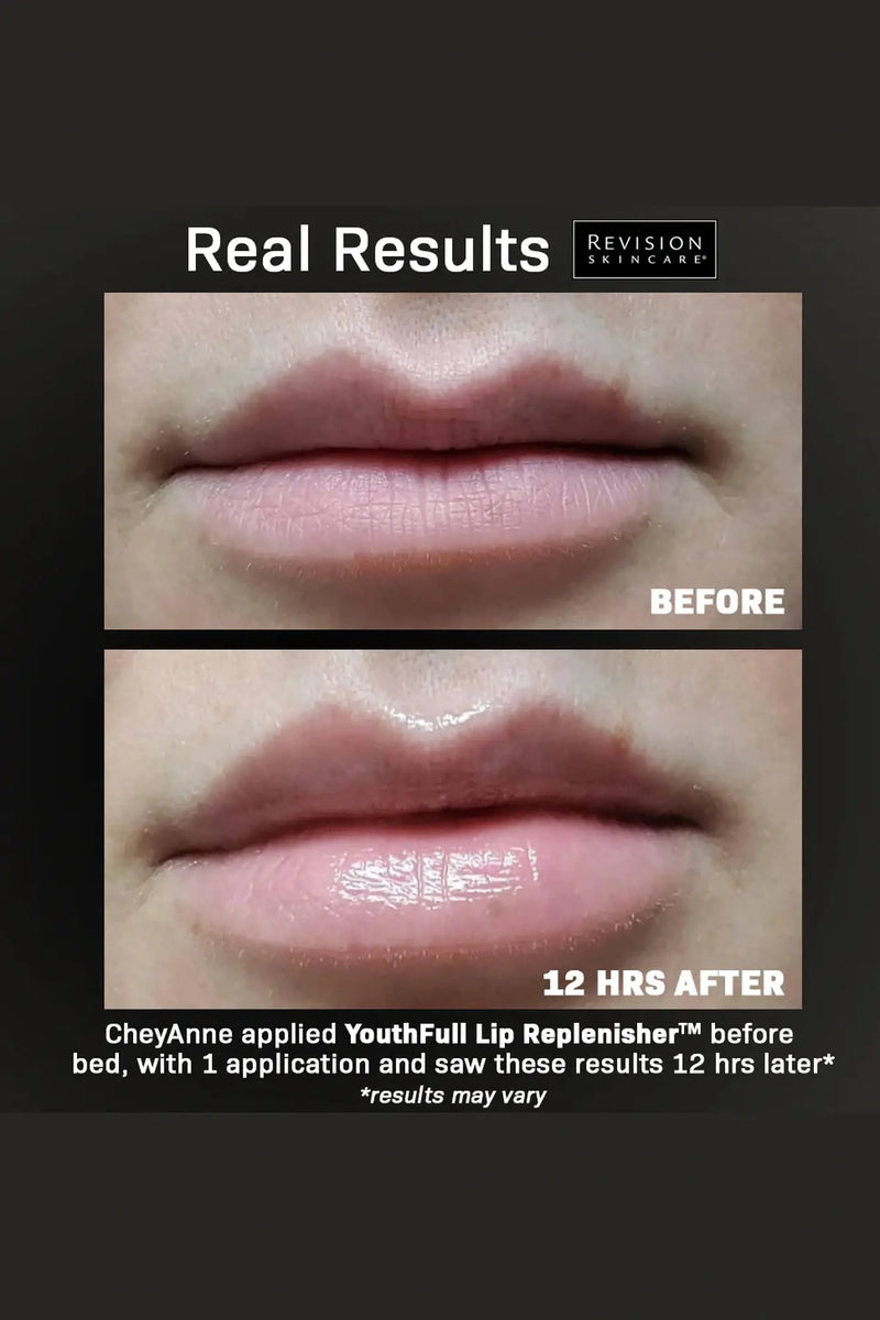 REVISION | YouthFull Lip Replenisher 0.33 oz