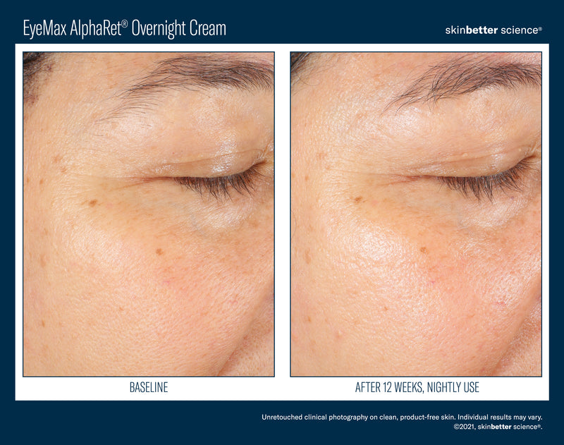 Skinbetter | EyeMax AlphaRet Overnight Cream