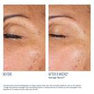 Skinbetter | EyeMax AlphaRet Overnight Cream
