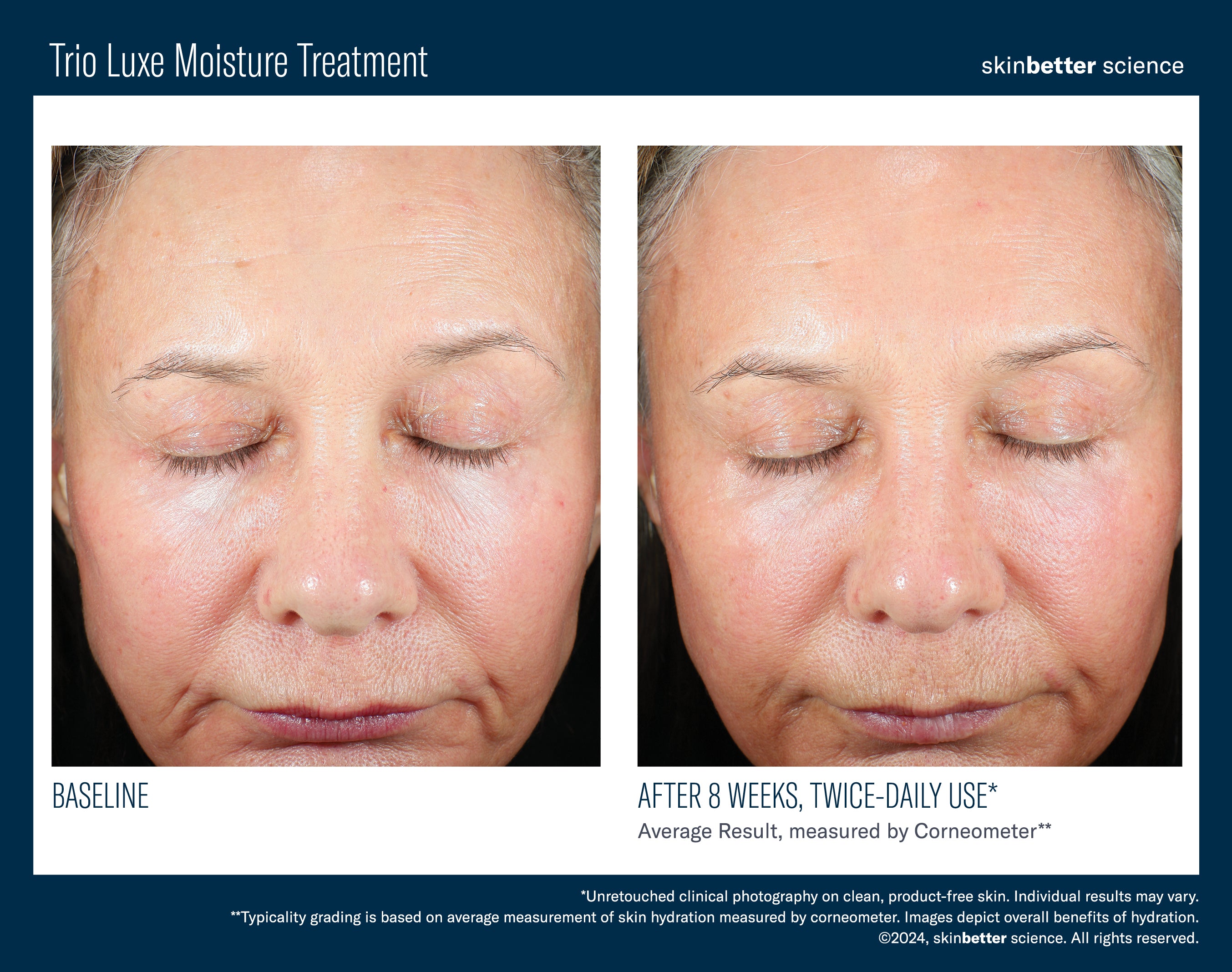 Skinbetter | Trio Luxe Moisture Treatment - Kept & Co